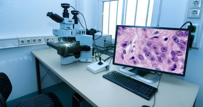 live cell imaging